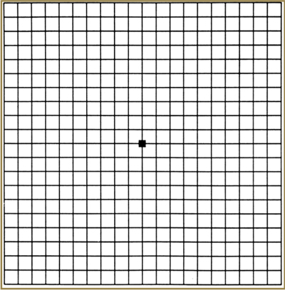 amsler-grid1